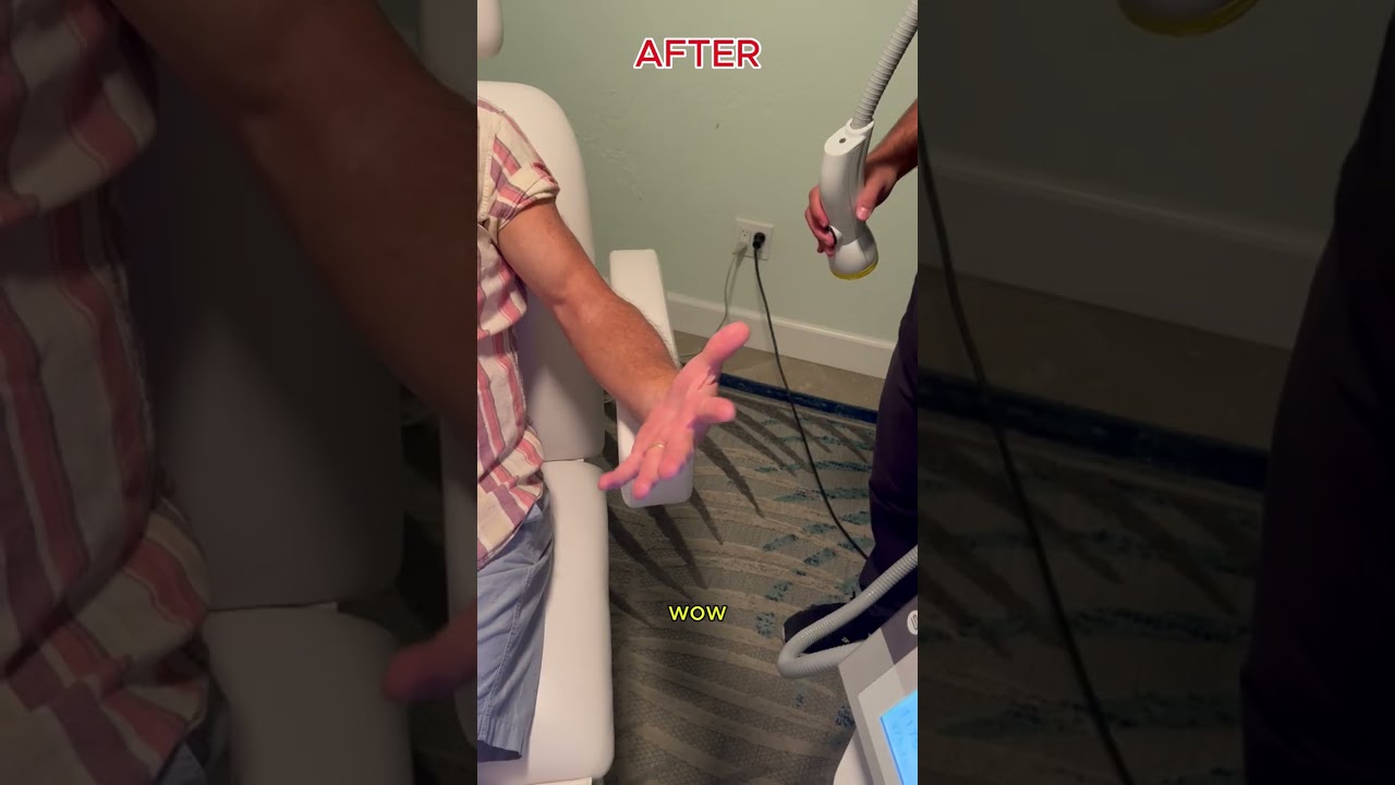 Carpal Tunnel Pain Relief in Solana Beach  SoftWave Therapy 