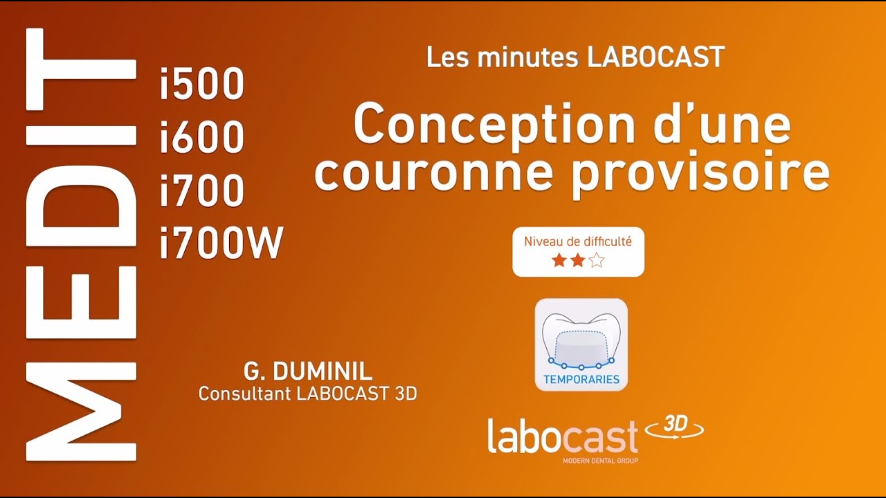 Conception d'une couronne provisoire