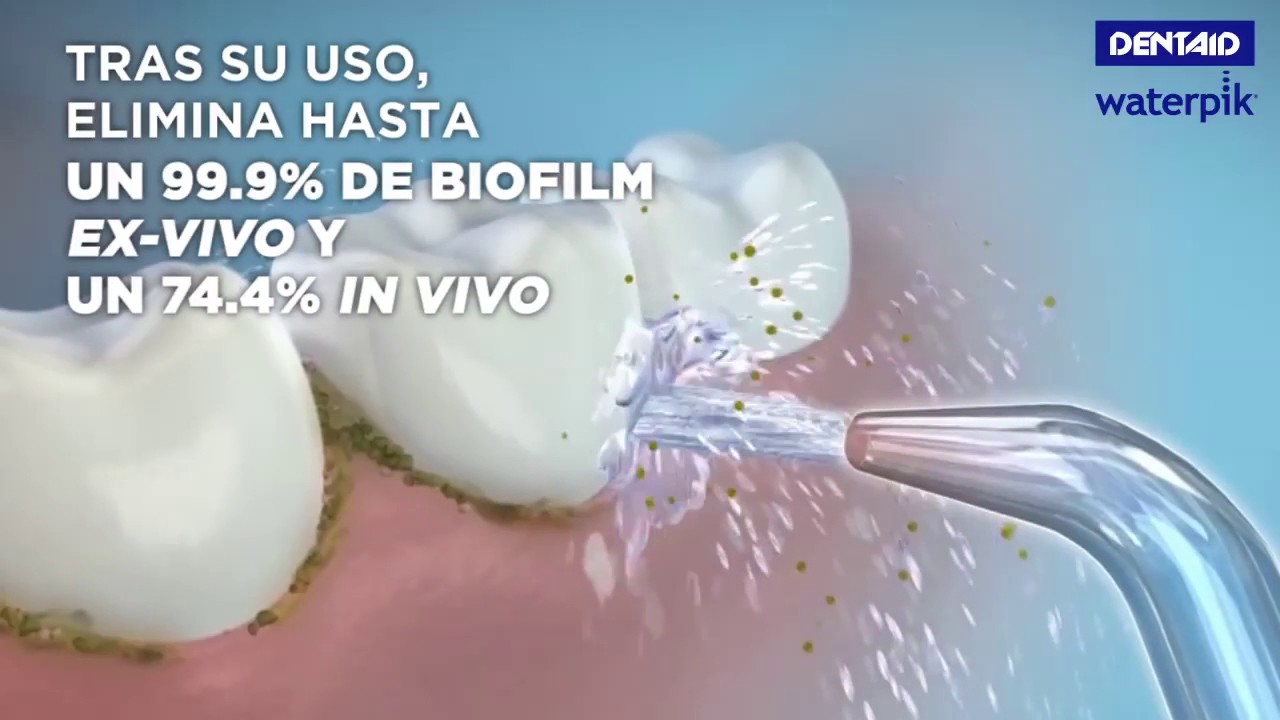 Irrigador dental: la mejor manera para completar nuestra higiene bucodental