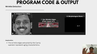 PROJECT IMAGES PROCESSING AND PATTERN RECOGNITION
