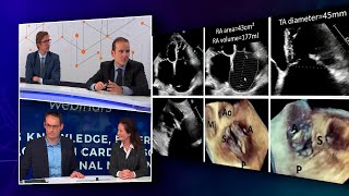 TRISCEND II: implications on current clinical practice - Webinar