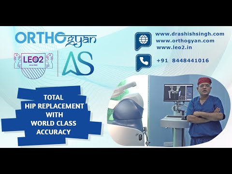 Robotic Hip Replacement Surgery with World Class Accuracy.