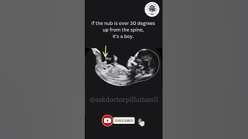 கருவில் இருக்கும் குழந்தை ஆணா?பெண்ணா? கண்டுபிடிப்பது எப்படி?  #doctorpillai #ultrasoundscan #shorts