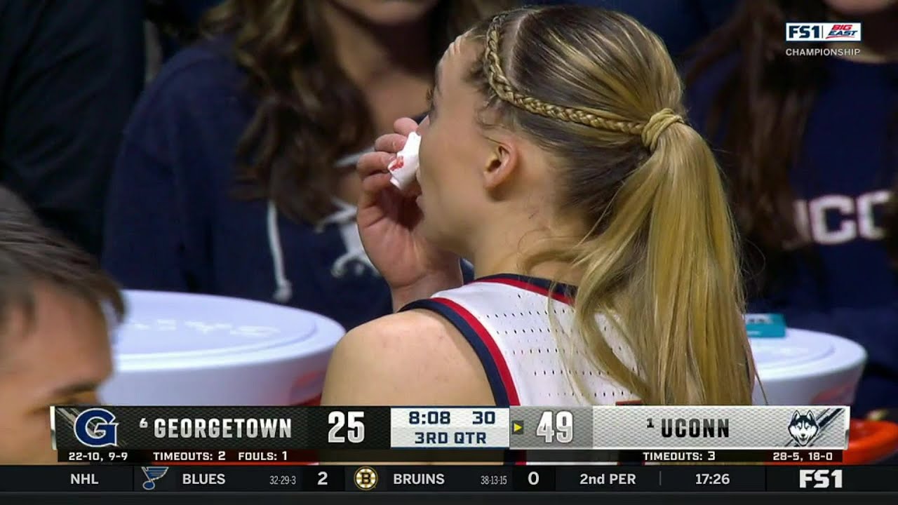 👀 Paige Bueckers BLOODY NOSE Not Reviewed In Big East Championship | UConn Huskies vs Georgetown