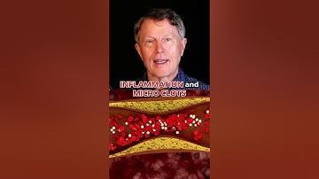 How I Use Aspirin to UNCLOG Arteries