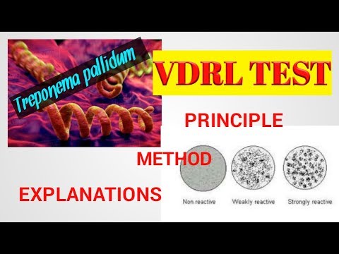 Vidéo: Test VDRL: Objectif, Procédure Et Résultats