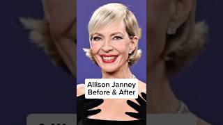 Allison Janney Before and After #shorts #allisonjanney #plasticsurgery