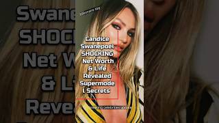 Candice Swanepoel SHOCKING Net Worth & Life Revealed 💰 | Supermodel Secrets 😱