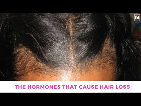 Video: Can The Hormones In Your Birth Control Lead To Hair Loss?