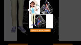 Stepwise USG in trauma Stepwise USG in trauma