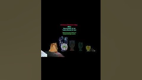 Volcanic eruption comparison