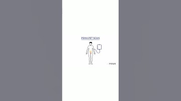 Can PSMA PET scans + traditional tests improve cancer detection?