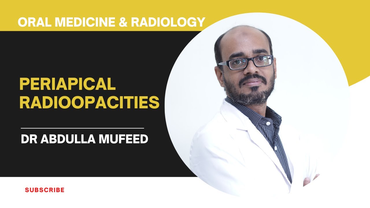 Periapical Radiopacities|Dr Abdulla Mufeed|HOD|Oral Medicine & Radiology