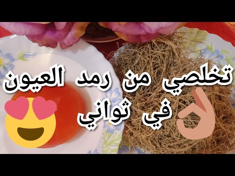 علاج رمد العيون في ثواني وبالبيت بطريقة رهيبة وسهلة
