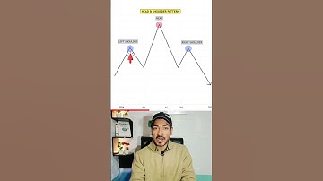Trade Head & Shoulder Pattern Like a Pro! 📈 #trading #stockmarket