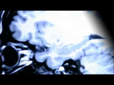 MARUG | Mind