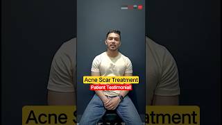 Acne And Scar Treatment: Patient Testimonial Real Results! | Clear Skin Clinic, Pune