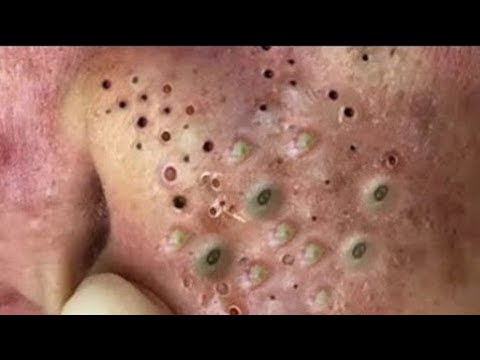 حلول طبيعية لبشرة صافية# 𝐒𝐤𝐢𝐧 𝐂𝐚𝐫𝐞 79296