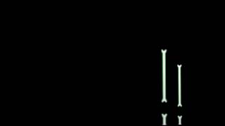 Toxic Sans Attack Bone Gaster Blaster