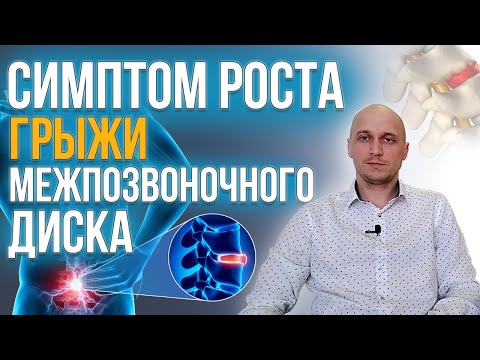 Симптом роста межпозвоночной грыжи пояснично-крестцового отдела позвоночника