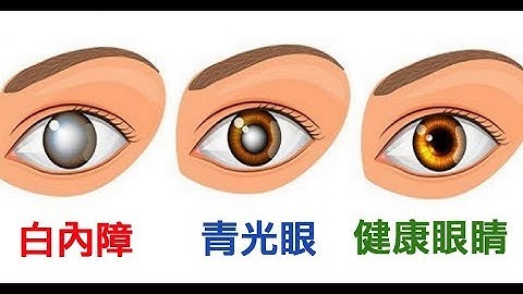 【警惕】50%盲人都因「青光眼」失明，9成患者不自知！醫：這「五種人」最危險 - 天天要聞