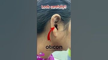 Oticon Ria 2 Custom made Completely in canal (CIC) Hearing aids #hearing #hearingloss #hearingaids