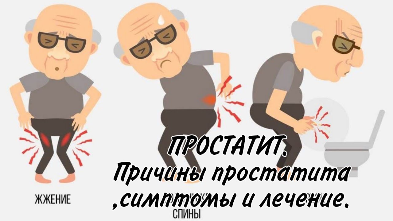 Воспаление простатита у мужчин. Проявления простатита.