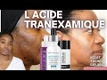 L acide tranexamique contre l hyperpigmentation comment l utiliser contre les taches et le melasma