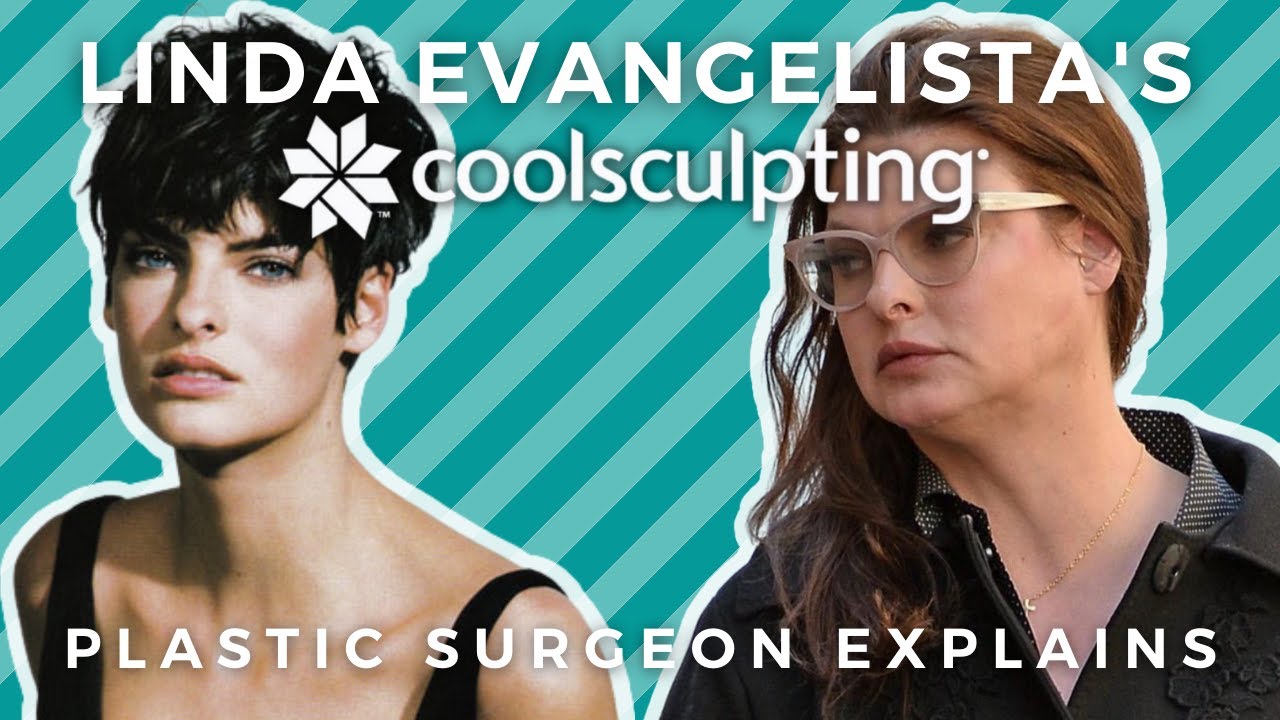 Linda Evangelista reveals the damage done by CoolSculpting
