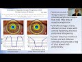 Orthokeratology Lenses: Addressing Myopic Refractive Error and Progression