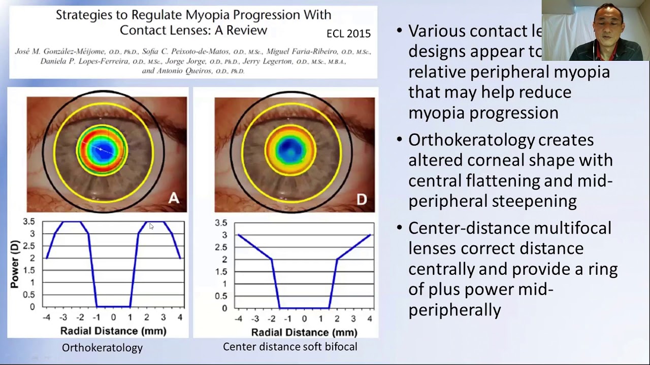 látásvesztés myopia