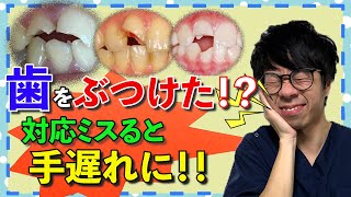 【手遅れ回避】歯が欠けた？抜けた？揺れた？対処と治療お伝えします！