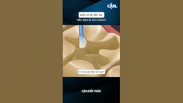 ĐIỀU GÌ SẼ XẢY RA NẾU BẠN BỊ SÂU RĂNG? #xuhuong #shorts #viral #khampha #kienthuc #cothebanchuabiet