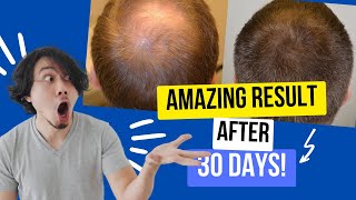 REVITALIZE your hair with FOLIFORT: the solution for Hair Loss ⚠️ ALERT ⚠️ FOLIFORT REVIEW