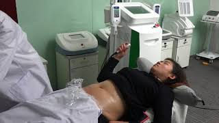 Nubway Cryolipolysis Slimming Machine NBW-C325B Operation Video