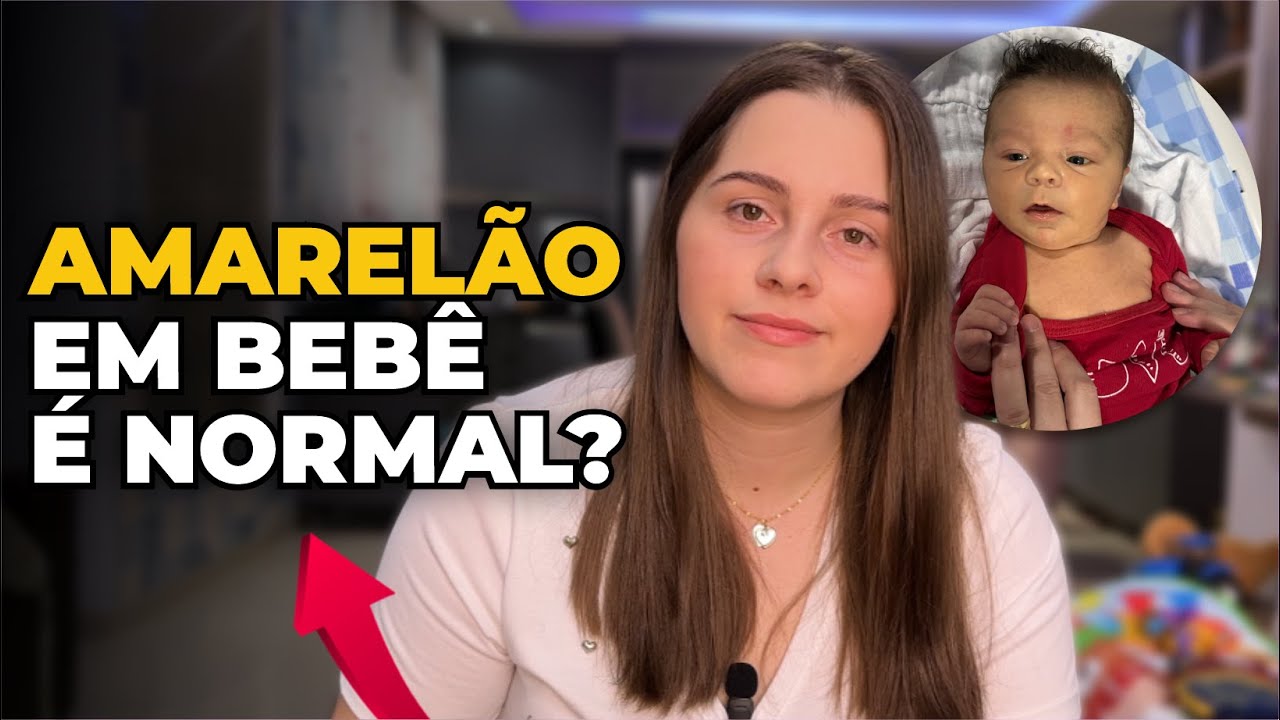 Tudo o que você precisa saber sobre Amarelão em bebês recém nascidos ...