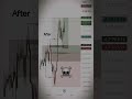 “XAUUSD Before &amp; After 🔥 | Planned Trade, Perfect Delivery”