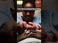 What Really Happens When a Woman Dilates to 10 CM During Labor? 😨🤰 #pregnancy #childbirth #fypシviral
