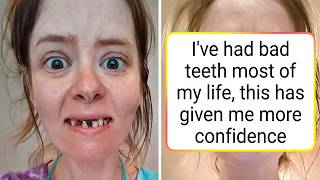 Side-by-Side Photos That Capture Transformations Worth a Double Take (New Pics)