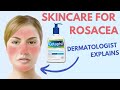 ROSACEA SKIN CARE | Dermatologist Review