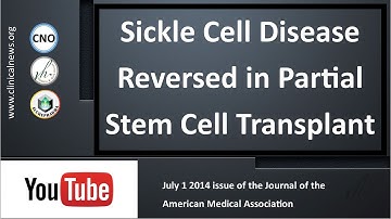 Sickle Cell Disease Reversed in Partial Stem Cell Transplant