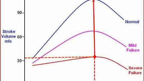 Hemodynamics Introduction - part 2 of 5