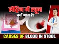 Causes of Blood in Stool Why is there blood in writing and reasons for blood in toilet?