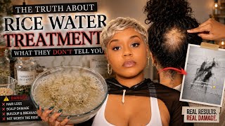 RICE WATER SCAMMERS EXPOSED TEAM NATURAL FAILS 2026
