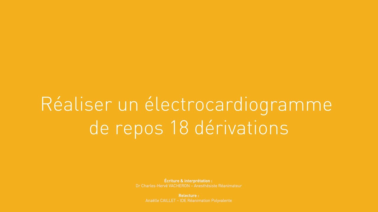 14 Réaliser un électrocardiogramme de repos 18 dérivations YouTube