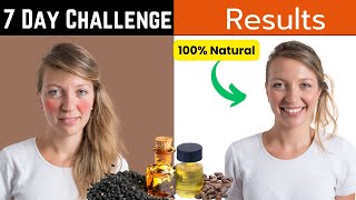I Tried Castor Oil and Black Seed for 7 Days: Unbelievable Results!