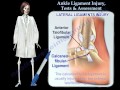 Ankle Ligament Injury Tests & Assessment - Everything You Need To Know - Dr. Nabil Ebraheim