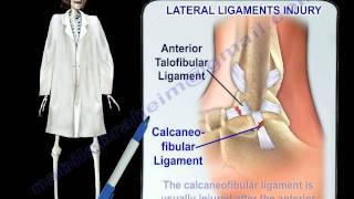 Ankle Ligament Injury Tests & Assessment - Everything You Need To Know - Dr. Nabil Ebraheim