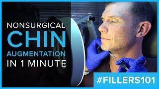 Nonsurgical Chin Augmentation 101 With San Francisco's Dr. Mabrie