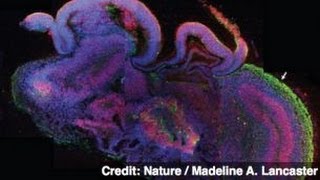 Scientists Build Tiny Human Brains in the Lab